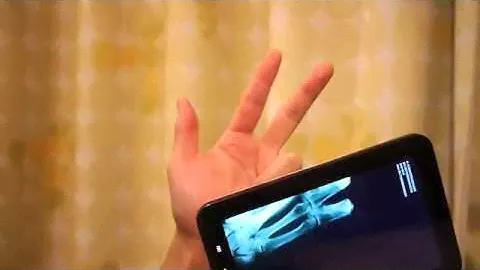 Рентген на мобильный телефон